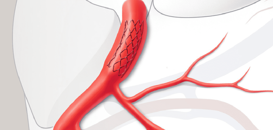  Cardiovascular and Thoracic Surgery